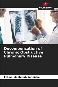 Paperback Decompensation of Chronic Obstructive Pulmonary Disease Book