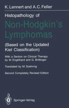 Paperback Histopathology of Non-Hodgkin's Lymphomas: (Based on the Updated Kiel Classification) Book