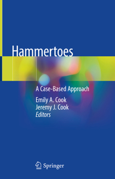 Hardcover Hammertoes: A Case-Based Approach Book