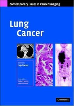 Lung Cancer - Book  of the Contemporary Issues in Cancer Imaging