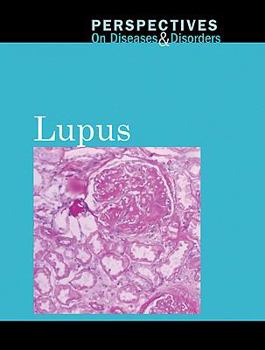 Library Binding Lupus Book