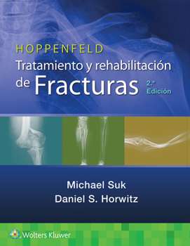 Paperback Hoppenfeld. Tratamiento Y Rehabilitación de Fracturas [Spanish] Book