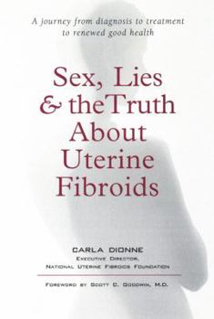 Paperback Sex, Lies, and the Truth about Uterine Fibroids Book