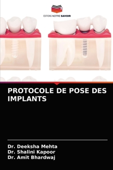 Paperback Protocole de Pose Des Implants [French] Book