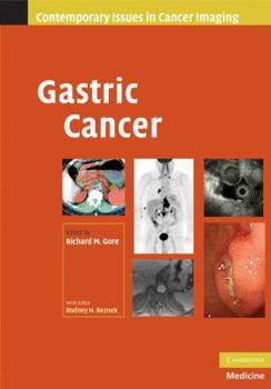 Gastric Cancer - Book  of the Contemporary Issues in Cancer Imaging