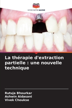 Paperback La thérapie d'extraction partielle: une nouvelle technique [French] Book