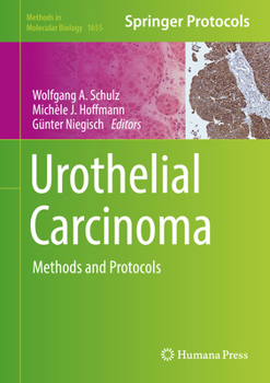 Hardcover Urothelial Carcinoma: Methods and Protocols Book