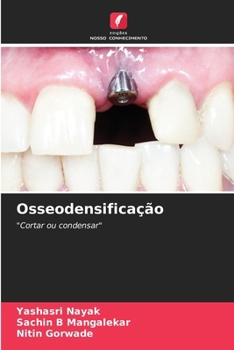 Paperback Osseodensificação [Portuguese] Book