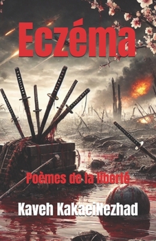Paperback Eczéma: Poèmes de la liberté [French] Book