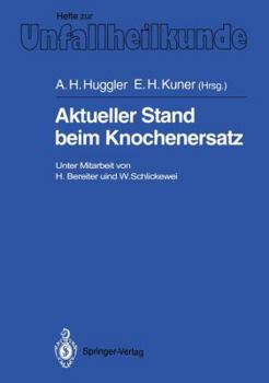 Paperback Aktueller Stand Beim Knochenersatz [German] Book