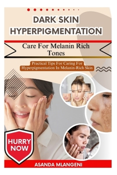 Paperback Dark Skin Hyperpigmentation Care For Melanin Rich Tones: Practical Tips For Caring For Hyperpigmentation In Melanin-Rich Skin Book