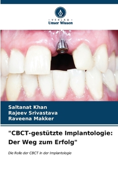 Paperback "CBCT-gestützte Implantologie: Der Weg zum Erfolg" [German] Book