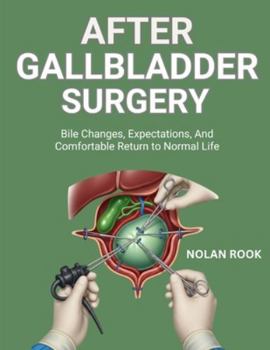 Paperback After Gallbladder Surgery: Bile changes, expectations, and comfortable return to normal life Book