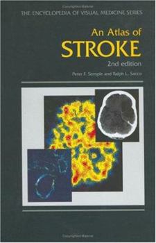 Hardcover An Atlas of Stroke, Second Edition Book