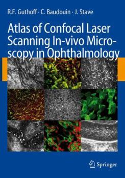 Hardcover Atlas of Confocal Laser Scanning In-Vivo Microscopy in Ophthalmology: Principles and Applications in Diagnostic and Therapeutic Ophtalmology Book
