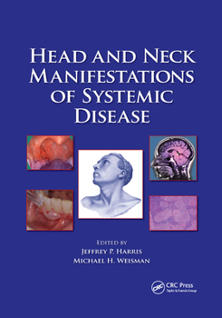 Paperback Head and Neck Manifestations of Systemic Disease Book