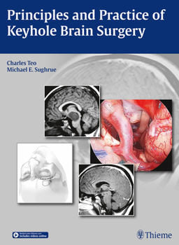 Hardcover Principles and Practice of Keyhole Brain Surgery Book