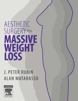 Hardcover Aesthetic Surgery After Massive Weight Loss Book