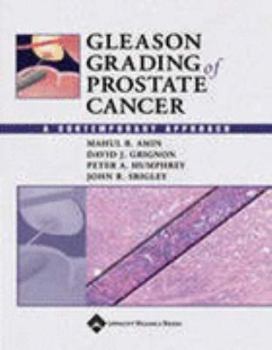Hardcover Gleason Grading of Prostate Cancer: A Contemporary Approach Book