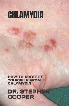 Paperback Chlamydia: How to Protect Yourself from Chlamydia Book