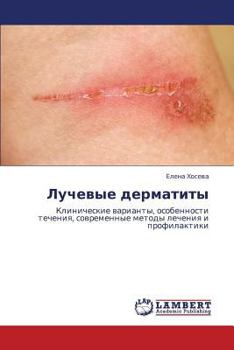 Paperback Luchevye Dermatity [Russian] Book