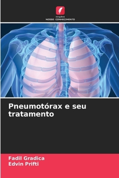 Paperback Pneumotórax e seu tratamento [Portuguese] Book