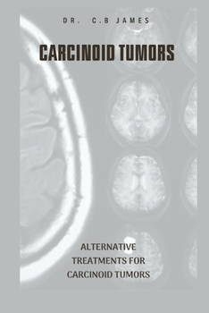 Paperback Carcinoid Tumors: Alternative Treatments for Carcinoid Tumors Book