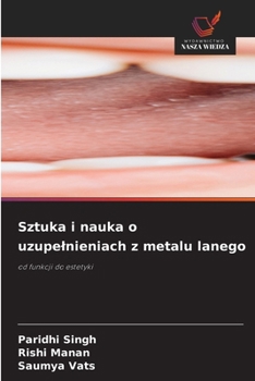 Sztuka i nauka o uzupelnieniach z metalu lanego (Polish Edition)