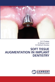 Paperback Soft Tissue Augmentation in Implant Dentistry Book