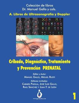 Paperback Cribado, Diagnóstico, Tratamiento y Prevención PRENATAL [Spanish] Book