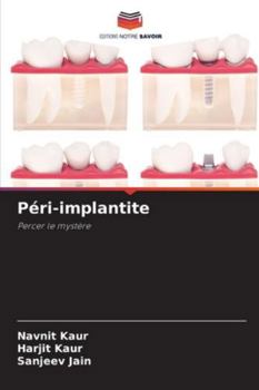 Paperback Péri-implantite [French] Book
