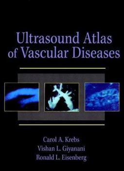 Hardcover Ultrasound Atlas of Vascular Disease Book