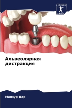 Альвеолярная дистракци&#