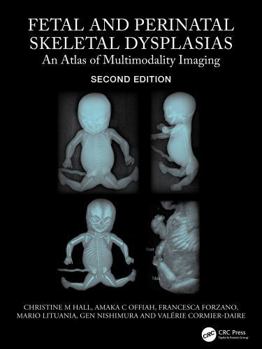 Hardcover Fetal and Perinatal Skeletal Dysplasias: An Atlas of Multimodality Imaging Book