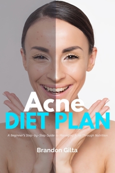 Paperback Acne Diet Plan: A Beginner's Step-by-Step Guide to Managing Acne Through Nutrition: With Curated Recipes and a Sample Meal Plan Book