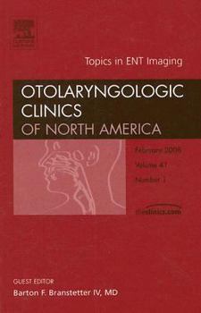 Hardcover Topics in Ent Imaging, an Issue of Otolaryngologic Clinics: Volume 41-1 Book