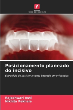 Posicionamento planeado do incisivo (Portuguese Edition)