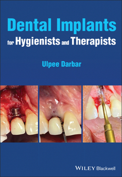 Paperback Dental Implants for Hygienists and Therapists Book