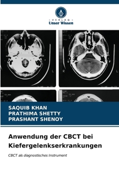 Paperback Anwendung der CBCT bei Kiefergelenkserkrankungen [German] Book