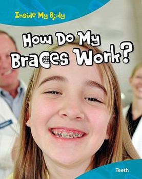 How Do My Braces Work?: Teeth - Book  of the Inside My Body