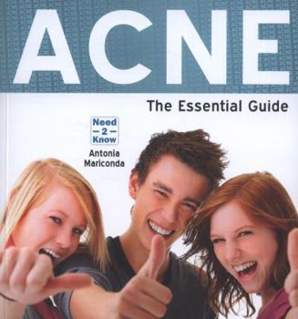 Paperback Acne - The Essential Guide Book