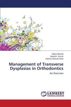 Paperback Management of Transverse Dysplasias in Orthodontics Book