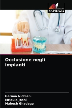 Paperback Occlusione negli impianti [Italian] Book