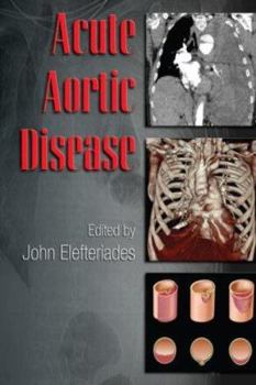 Hardcover Acute Aortic Disease Book