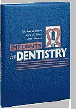 Hardcover Implants in Dentistry: Essentials of Endosseous Implants for Maxillofacial Reconstruction Book