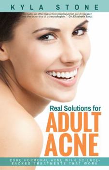 Real Solutions for Adult Acne: Cure Hormonal Acne with Science-Backed Treatments that Work