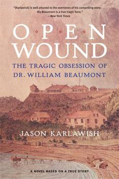 Paperback Open Wound: The Tragic Obsession of Dr. William Beaumont Book