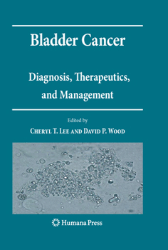 Paperback Bladder Cancer: Diagnosis, Therapeutics, and Management Book