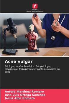 Acne vulgar (Portuguese Edition)