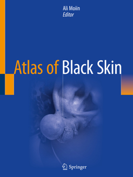 Paperback Atlas of Black Skin Book